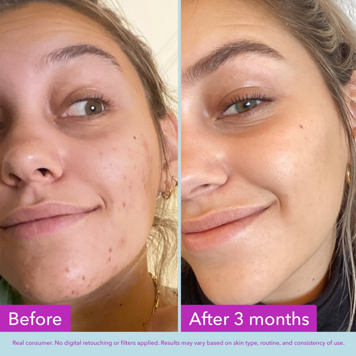 niacinamide-brightening-toner-a2 zb_p.jpg
