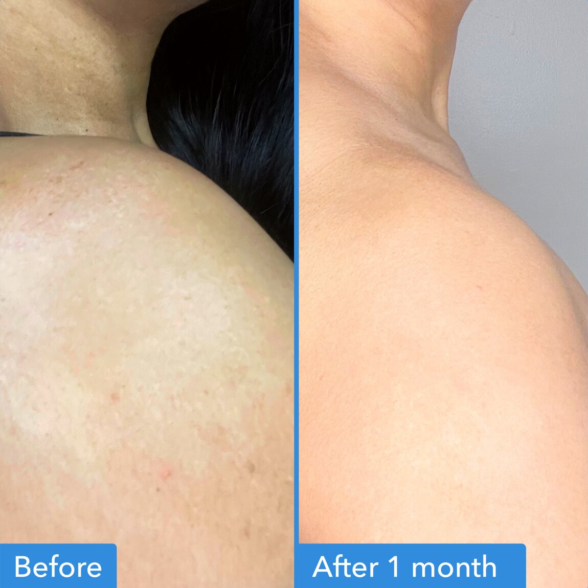 discoloration-correcting-body-treatment-u3 zb_p.jpg