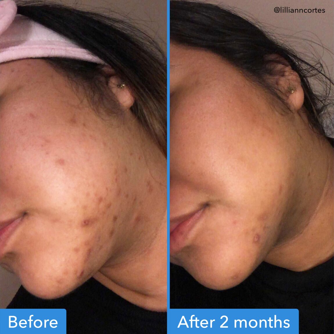 discoloration-correcting-serum-b6 zb_p.jpg